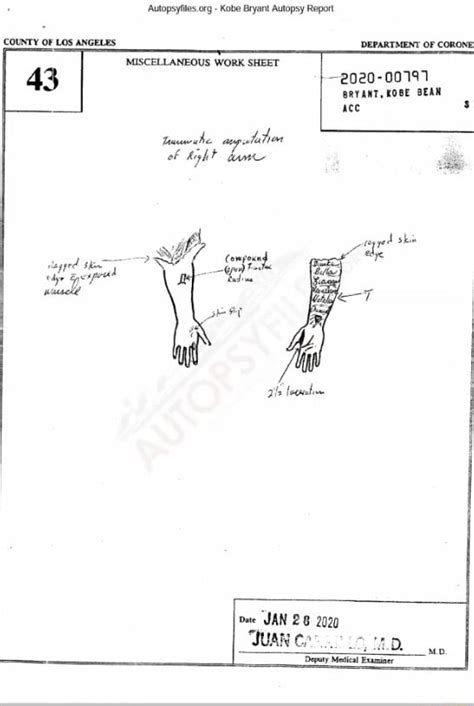 kobe brayant autopsy|Autopsyfiles.org